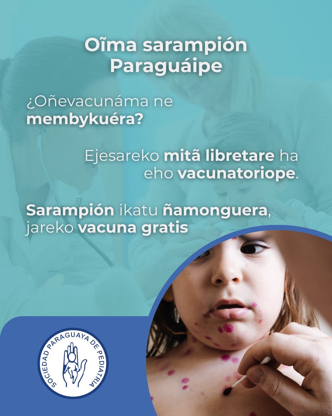 Sarampión en Paraguay